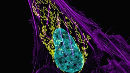 Cell Lines for Oncology: Carcinomas, Sarcomas, Hematologic Cancers & More