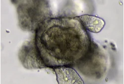 intestinal organoids