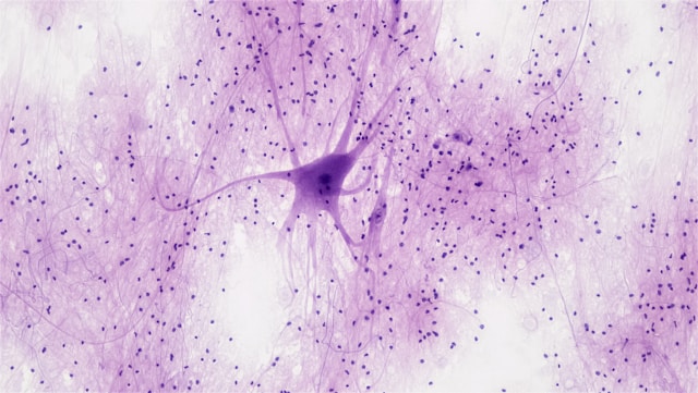 ALS research and cell models